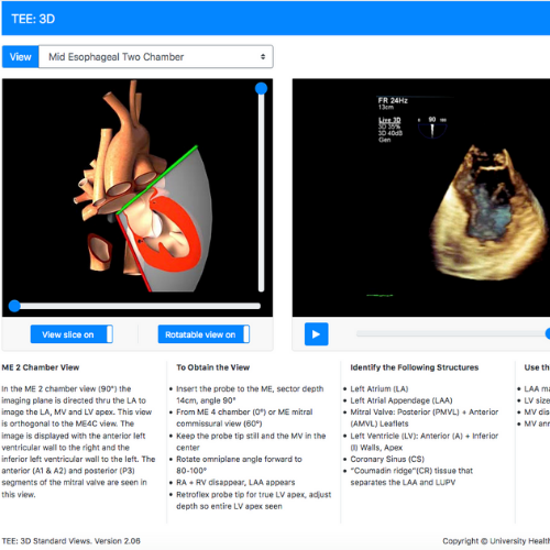 U of T TEE Simulator